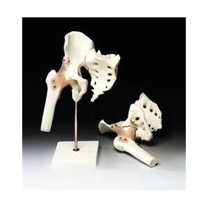  Hip Joint Model with Ligaments 