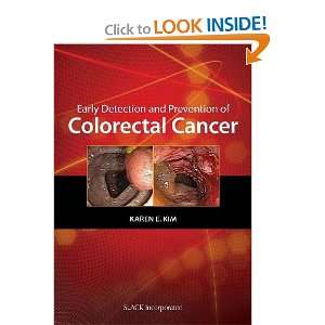   Cancer (Curbside Consultation) (9781556428371) Karen Kim MD Books